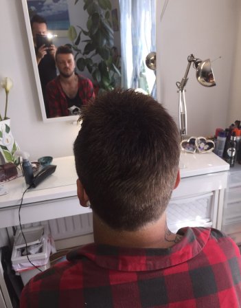 Men’s hair loss treatment and replacement in London – Sofia’s Crown